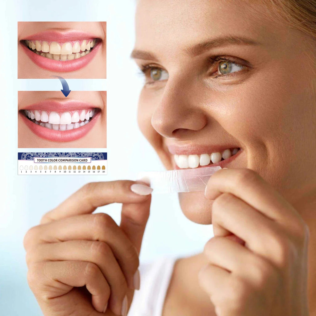Teeth Whitening Strips 14-Pack